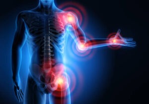 Arthritis Treatment 300x210 1
