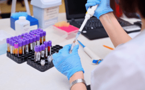 Lab Testing Blood Work 300x186 1
